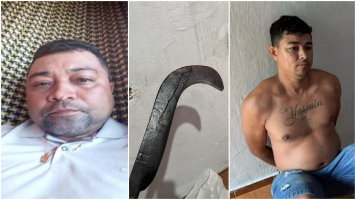 Caso Ana Clara: MP pede que irmãos sejam condenados a pagar R$ 97 mil a mulher que teve mãos decepadas