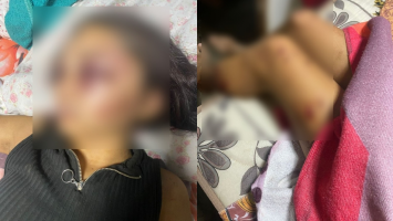 Adolescente é sequestrada e tem rosto desfigurado após agressões de namorado no Ceará