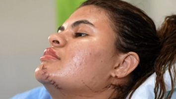 'Estava consciente o tempo todo', afirma Ana Clara ao relembrar ataque em que teve mãos decepadas pelo cunhado