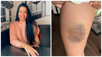 Nutricionista cearense que lutou contra homem para não ser estuprada em SP diz que aprendeu artes marciais em Fortaleza