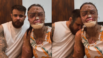 Influencer cearense com doença rara revela diagnóstico de metástase: ‘Difícil continuar sendo forte’